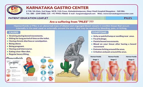 Hemorrhoids treatment illustration